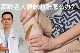 高龄老人静脉曲张破裂怎么办？图片