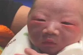​嫌刚生下来的孩子丑？别着急下结论，宝宝颜值和这三个因素有关图片