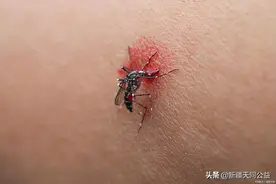 蚊子吸了“艾滋病”病人的血，又咬了一个正常人，会被传染吗？图片