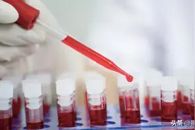 希望曙光？女子感染HIV数年后居然奇迹自愈了...图片