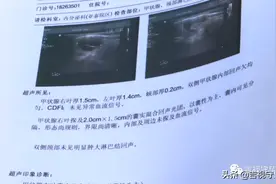 能治病，还能恢复青春？75岁老人美容院消费五万多图片