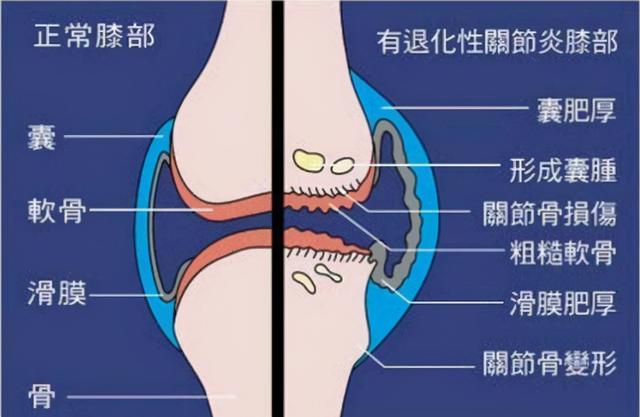 肌腺症吃花胶 2026年肌腺症吃花胶好吗