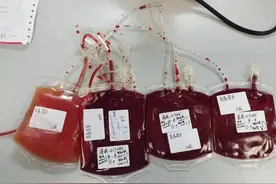 “熊猫血”妈妈生育二胎有顾虑？市六医院为她全周期保驾护航图片