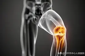 「推介」臭氧注射治疗膝关节炎图片
