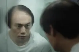 都是掉毛的动物，凭啥只有人类会秃图片