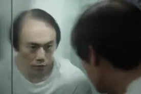 都是掉毛的动物，凭啥只有人类会秃图片
