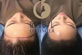 女士发际线有哪几种图片