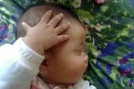 1岁宝宝总“摸头”，妈妈发觉不对劲带去检查，医生：还好来得早图片