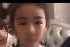家长给7岁女儿割双眼皮，真相浮出水面，网友：颜值有那么重要吗图片