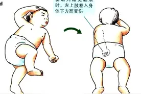 孩子胳膊被拽后为何不能动了？图片