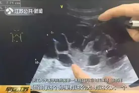 无知！为买新款苹果手机，20岁女孩地下诊所卖卵，报酬仅1万图片