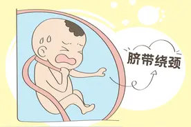 宝宝脐带绕颈，大部分来源于孕妈的坏习惯，赶紧改正吧图片