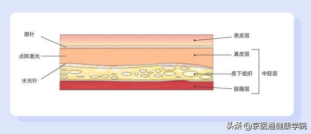 銆岃彶娲涘槈銆嶈繕鑳戒笉鑳芥墦锛熷浗鍐呭凡缁忔湁浜嗐€屽悎娉曟浛浠ｅ搧銆? onerror=