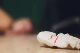 流鼻血高发季到了，伴有5类症状请立即就医图片