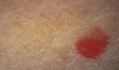 身体乳瓶盖压嘴结构