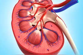 输尿管狭窄是怎么回事？图片