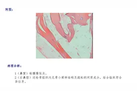 鼻子里竟然长出了牙齿，还足足有3厘米长......图片