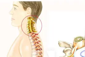 手指麻木、疼痛，多由这9种疾病导致！如何诊断治疗？医生告诉您图片