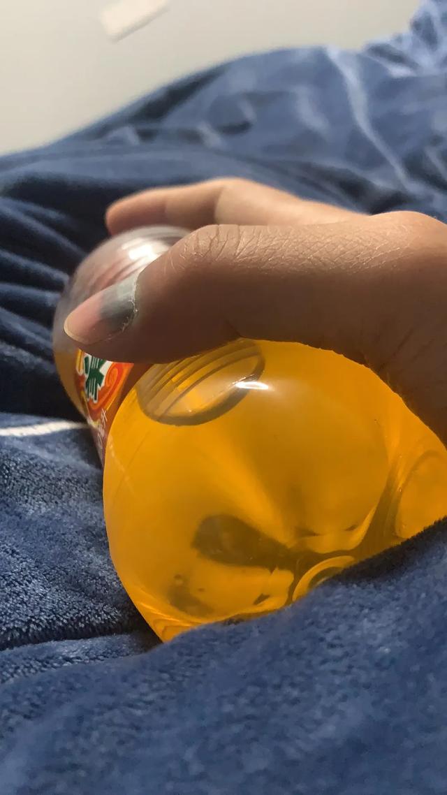 指甲盖被砸了有瘀血怎么办