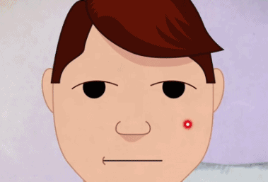 空心斑是汗孔角化症吗