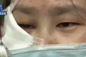 大姐骑车过门禁，摔到整张脸都肿了图片