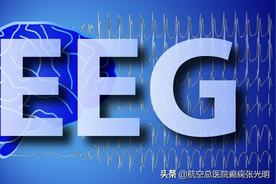 「科普」带你快速认识脑电图图片