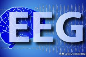 「科普」带你快速认识脑电图图片