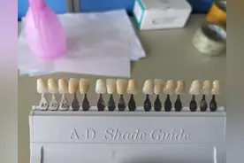 花十多万元种植全口假牙后，我的无力感慨（三）图片