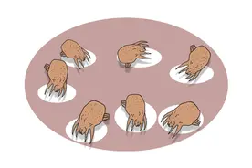 头皮上为何会出现“剪发虫”？人会有什么感觉？3招教你去除图片