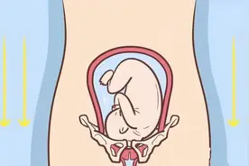 产后耻骨分离能自己恢复吗？图片