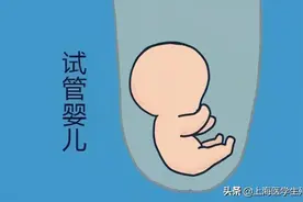 试管婴儿对子宫环境有哪些要求？图片
