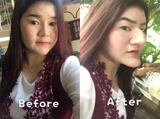泰国女子花重金把自己整成老巫婆，网友：下巴可以当水果刀了