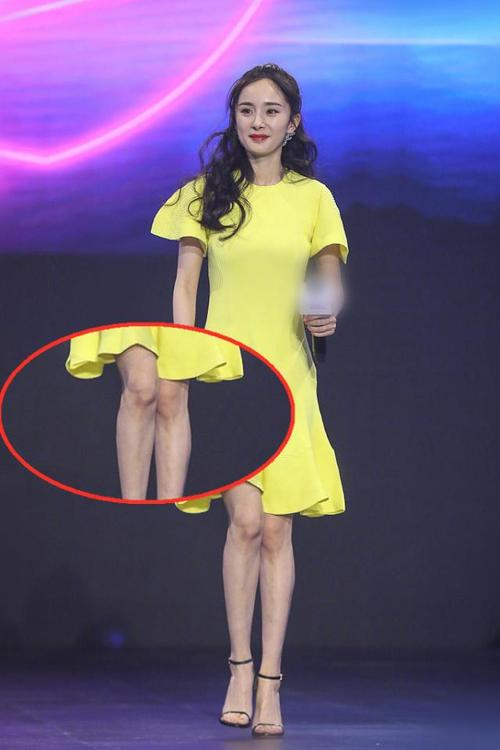 女生身上鸡皮肤好吗