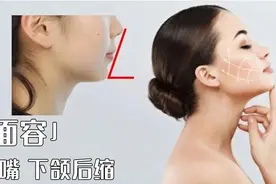 侧颜不好看？这三个坏习惯你中枪了吗？「一个矫正动作优化侧颜」图片