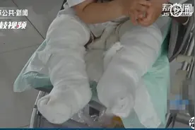 不能大意！家长不试水温男童洗澡被烫伤图片