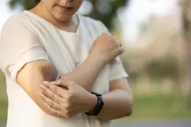 轻碰就瘀青？不是皮肤嫩，当心身体潜藏4疾病图片