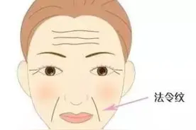 法令纹是如何形成的？怎么改善弱化法令纹？图片