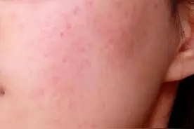 女生日常坚持5个护肤步骤，修护皮肤屏障，改善敏感肌图片