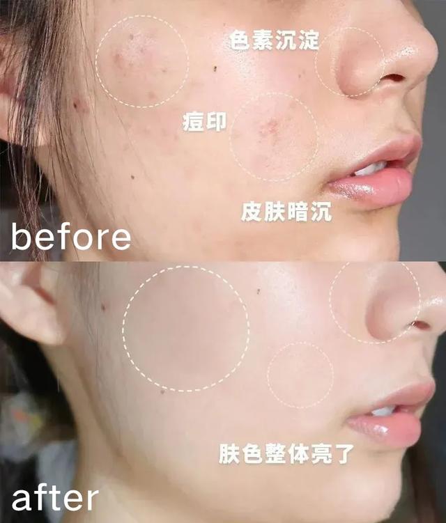 一张干净的脸，是女人最直接的吸引力