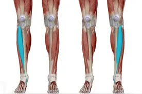 「拉直美腿」摆脱骨盆前倾、膝超伸，每天5组拉伸就够了图片