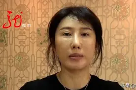 打了13针瘦脸针，女子半边脸斜了，下巴也歪了！连笑都不会了图片