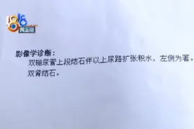 术后小便一直出血，手术支架漏取一个图片