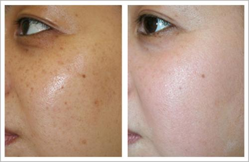 美白身体乳好还是vc粉好