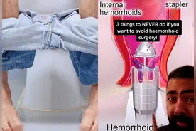 英国医生建议：上厕所最好不要超过10分钟，如果你想避免手术的话图片