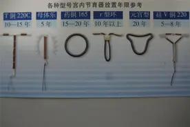 节育环“超期服役”危害大，有三种表现及时取出，越拖越受伤图片