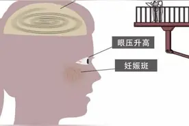 女生从怀孕到生子所经历的"痛苦"，产后抑郁被说“矫情”图片