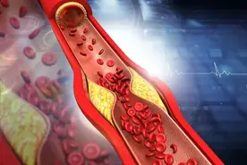 胆固醇升高，不要怕，哈佛大学：常吃这5种食物，胆固醇悄悄降图片