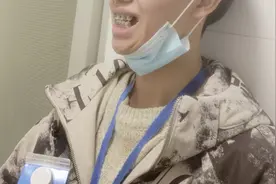 带牙套四个月了图片