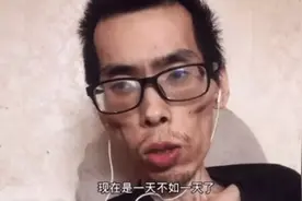 患肠癌1年后，34岁小伙成“骷髅人”，提醒：50岁前改掉3个坏毛病图片