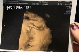 孕妈这4种反应，多半怀了个“小捣蛋鬼”，宝妈以后要多操心了图片